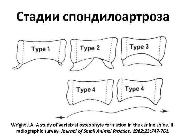 Стадии спондилоартроза Wright J. A. A study of vertebral osteophyte formation in the canine