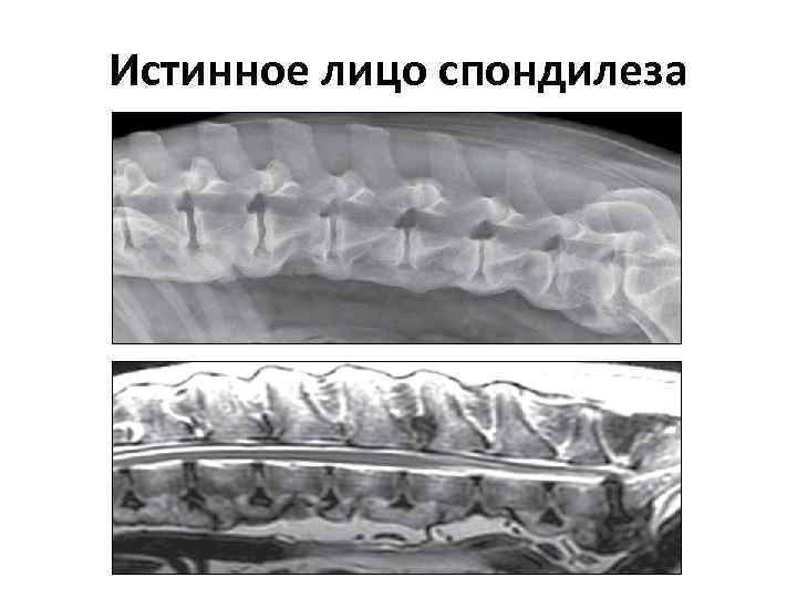 Истинное лицо спондилеза 