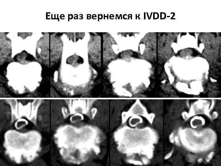 Еще раз вернемся к IVDD-2 