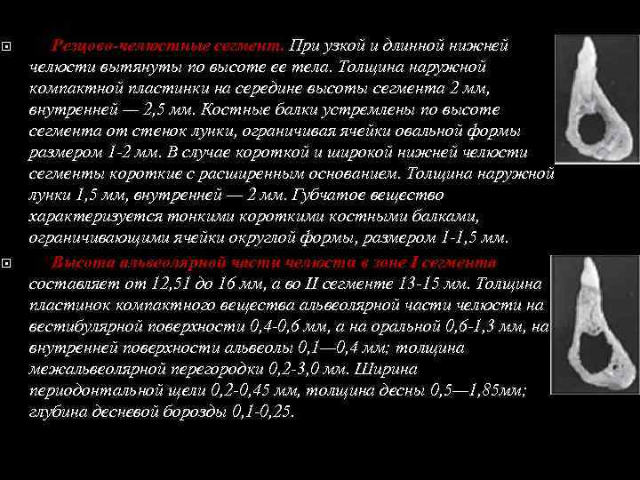  Резцово-челюстные сегмент. При узкой и длинной нижней челюсти вытянуты по высоте ее тела.