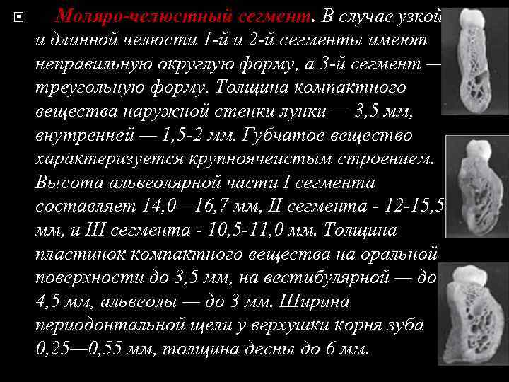  Моляро-челюстный сегмент. В случае узкой и длинной челюсти 1 -й и 2 -й