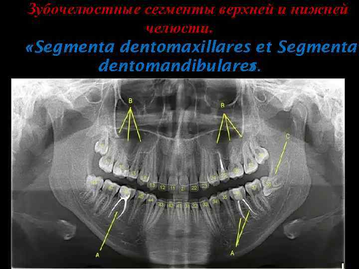 Зубочелюстные сегменты верхней и нижней челюсти. «Segmenta dentomaxillares et Segmenta dentomandibulares. » 