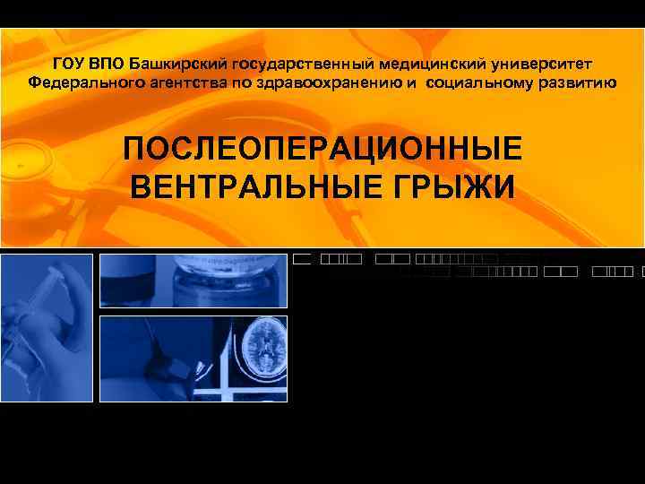 ГОУ ВПО Башкирский государственный медицинский университет Федерального агентства по здравоохранению и социальному развитию ПОСЛЕОПЕРАЦИОННЫЕ