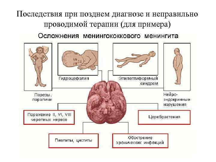 Последствия при позднем диагнозе и неправильно проводимой терапии (для примера) 