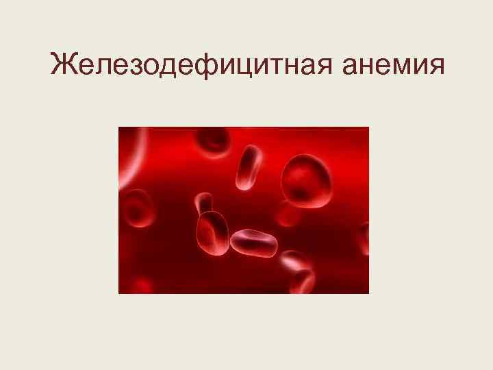 Железодефицитная анемия 