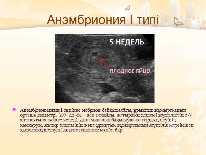 Анэмбриония І типі Анэмбрионияның І типінде эмбрион байқалмайды, ұрықтық жұмыртқаның орташа диаметрі 2, 0–