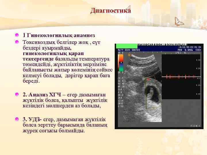 Диагностика 1 Гинекологиялық анамнез Токсикоздық белгілер жоқ , сүт бездері ауырмайды, гинекологиялық қарап тексергенде
