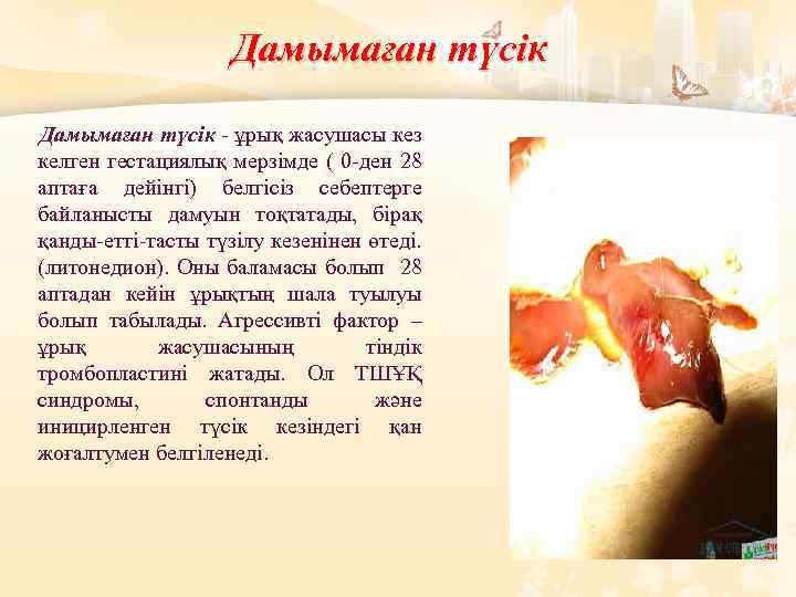 Дамымаған түсік - ұрық жасушасы кез келген гестациялық мерзімде ( 0 -ден 28 аптаға