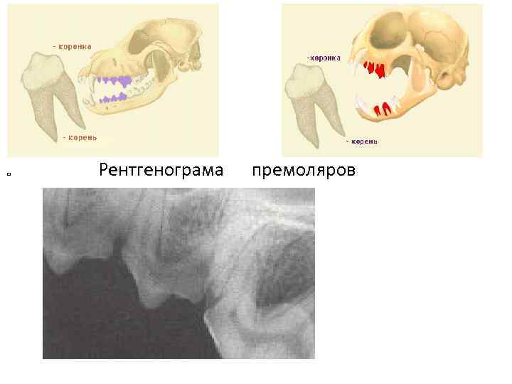  Рентгенограма премоляров 