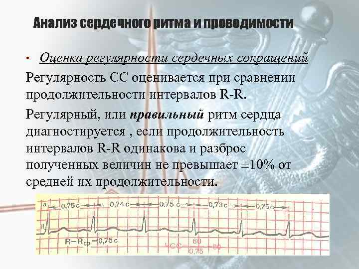 Анализ сердечного ритма и проводимости • Оценка регулярности сердечных сокращений Регулярность СС оценивается при