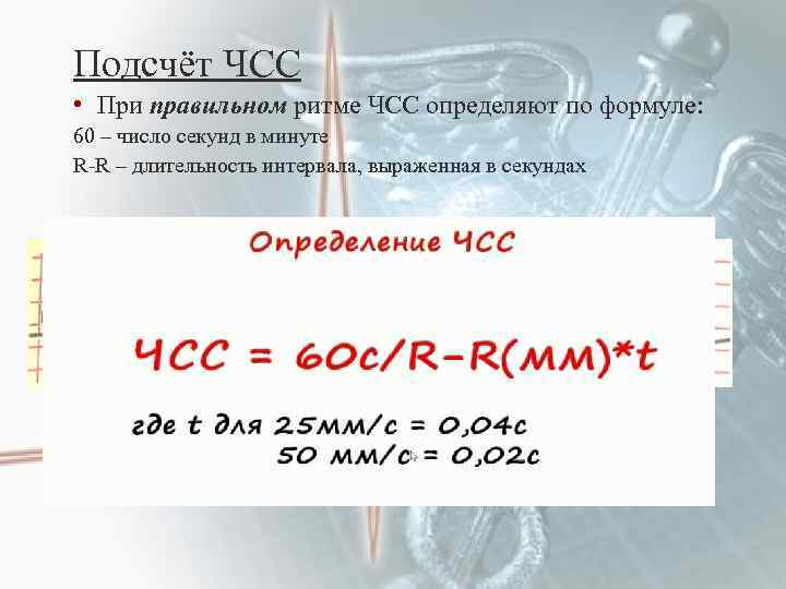 Как посчитать чсс на экг по клеточкам. Частота сердечных сокращений по ЭКГ формула. Расчет по ЭКГ частоты сердечных сокращений. Формула подсчета ЧСС по ЭКГ. Подсчет ЧСС на ЭКГ 50 мм/с.