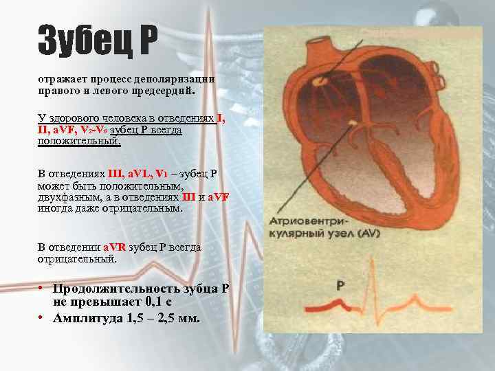 Зубец Р отражает процесс деполяризации правого и левого предсердий. У здорового человека в отведениях