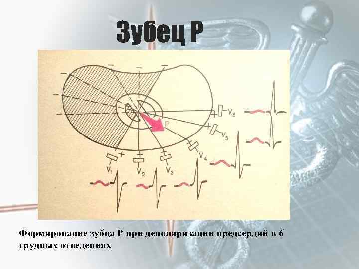 Зубец P Формирование зубца Р при деполяризации предсердий в 6 грудных отведениях 