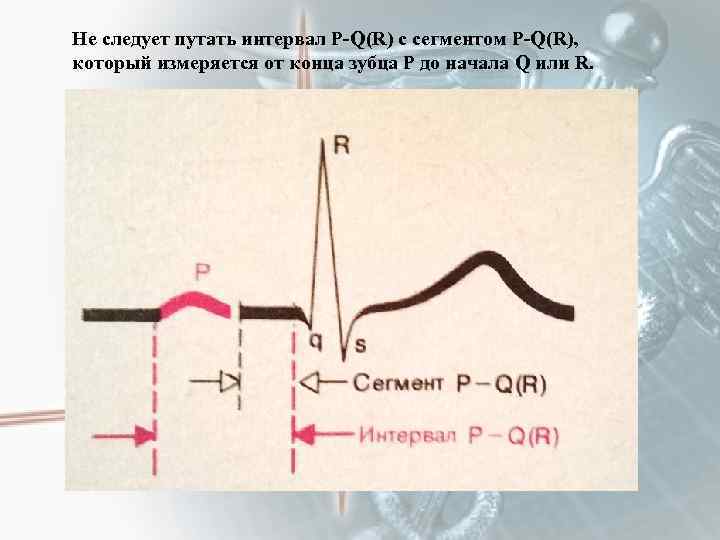 Не следует путать интервал P-Q(R) c сегментом P-Q(R), который измеряется от конца зубца Р