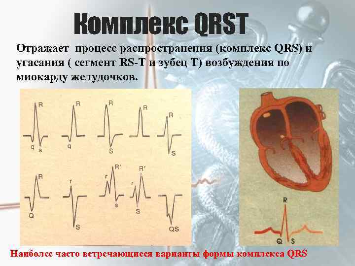 Комплекс QRSТ Отражает процесс распространения (комплекс QRS) и угасания ( сегмент RS-T и зубец