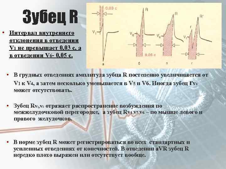 Зубец R • Интервал внутреннего отклонения в отведении V 1 не превышает 0, 03