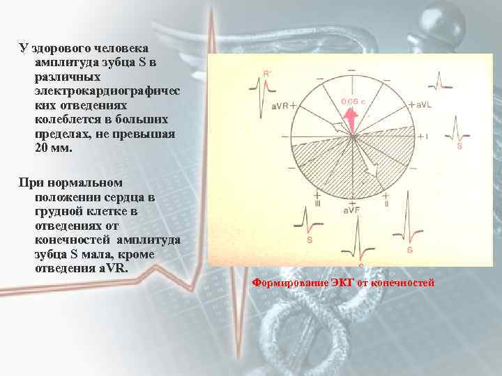 У здорового человека амплитуда зубца S в различных электрокардиографичес ких отведениях колеблется в больших