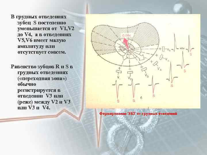 В грудных отведениях зубец S постепенно уменьшается от V 1, V 2 до V