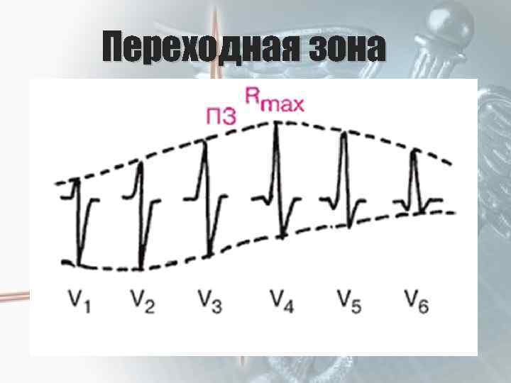 Переходная зона 