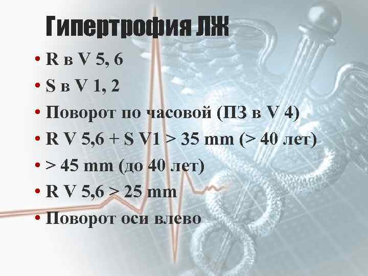 Гипертрофия ЛЖ • R в V 5, 6 • S в V 1, 2