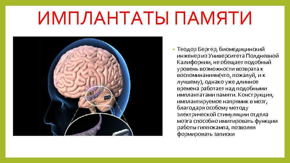 ИМПЛАНТАТЫ ПАМЯТИ • Теодор Бергер, биомедицинский инженер из Университета Полдневной Калифорнии, не обещает подобный