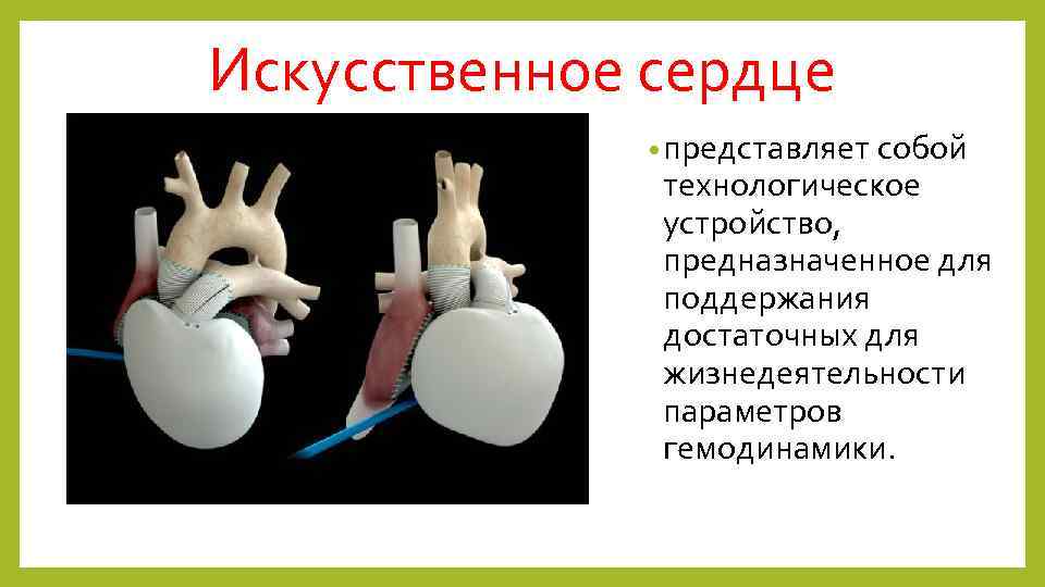 Искусственное сердце • представляет собой технологическое устройство, предназначенное для поддержания достаточных для жизнедеятельности параметров