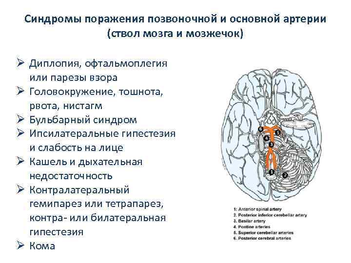 Синдромы поражения позвоночной и основной артерии (ствол мозга и мозжечок) Ø Диплопия, офтальмоплегия или