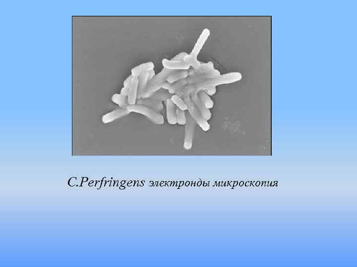 C. Perfringens электронды микроскопия 