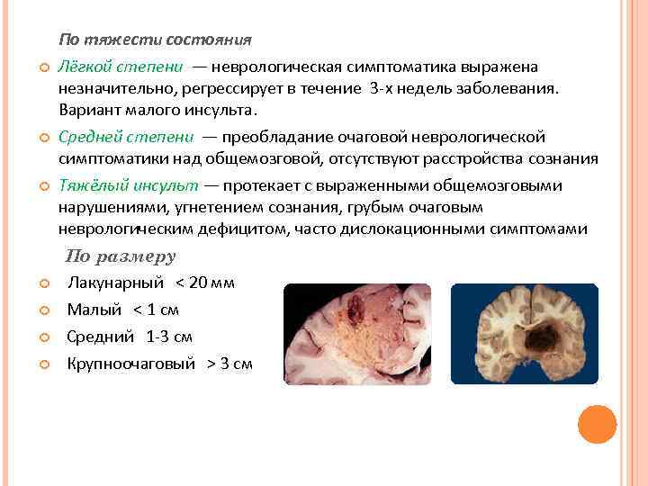 По тяжести состояния Лёгкой степени — неврологическая симптоматика выражена незначительно, регрессирует в течение 3