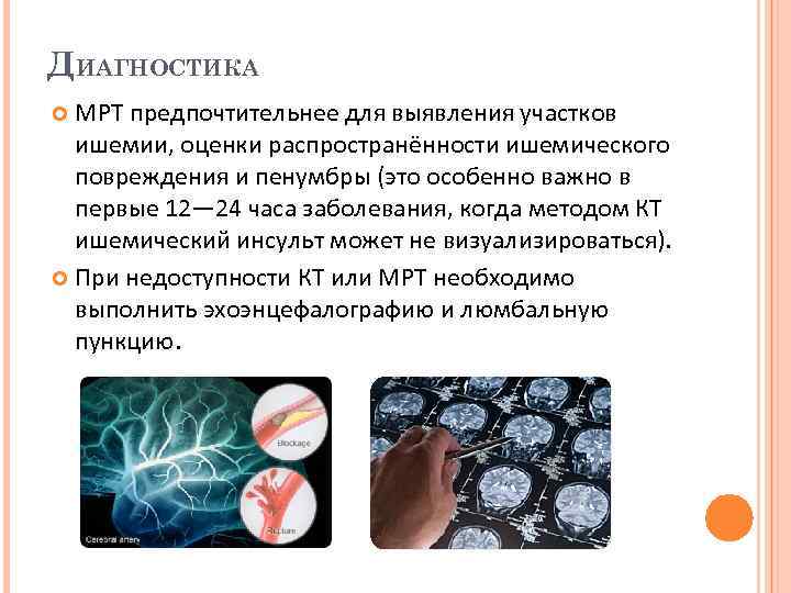 ДИАГНОСТИКА МРТ предпочтительнее для выявления участков ишемии, оценки распространённости ишемического повреждения и пенумбры (это