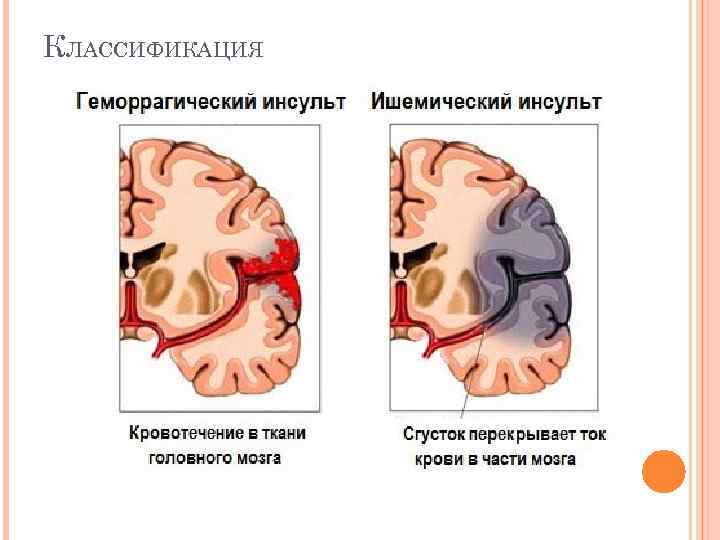 КЛАССИФИКАЦИЯ 
