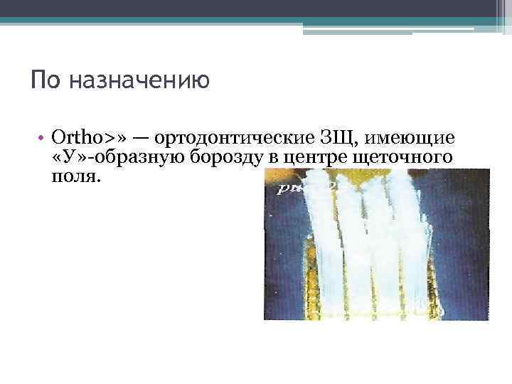 По назначению • Оrtho>» — ортодонтические ЗЩ, имеющие «У» образную борозду в центре щеточного
