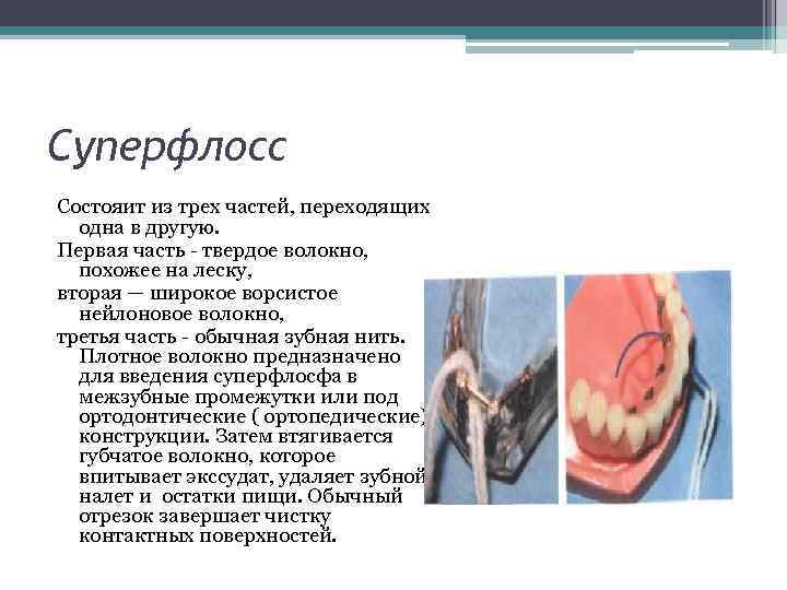 Суперфлосс Состояит из трех частей, переходящих одна в другую. Первая часть твердое волокно, похожее
