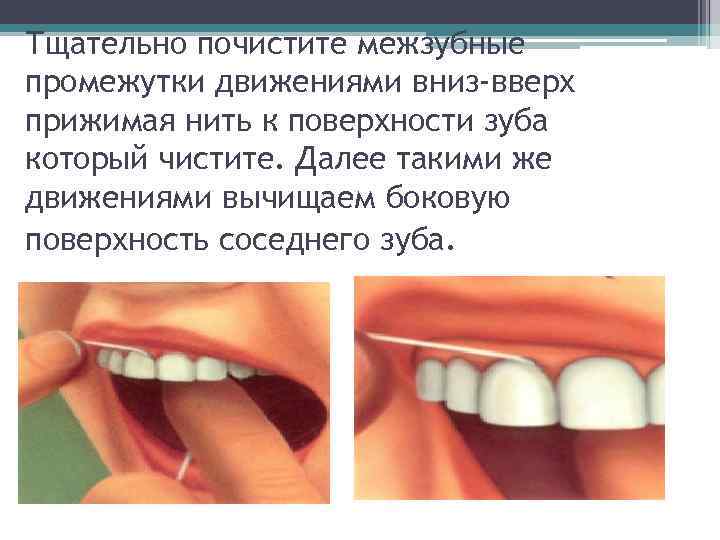 Тщательно почистите межзубные промежутки движениями вниз-вверх прижимая нить к поверхности зуба который чистите. Далее