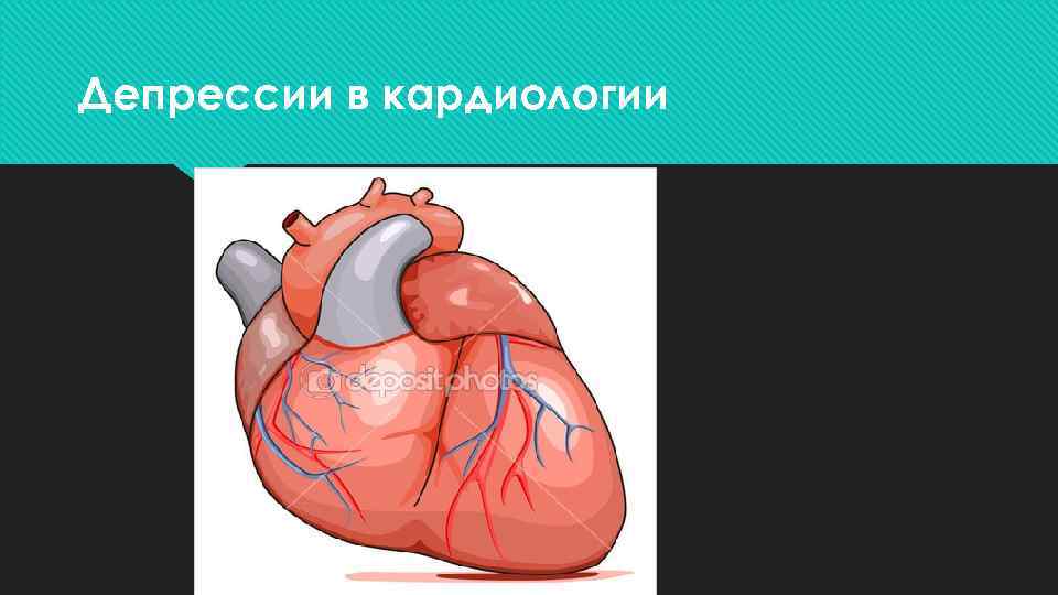 Депрессии в кардиологии 