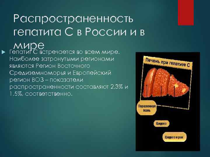  Распространенность гепатита С в России и в мире Гепатит С встречается во всем