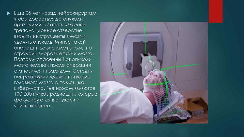  Еще 35 лет назад нейрохирургам, чтобы добраться до опухоли, приходилось делать в черепе