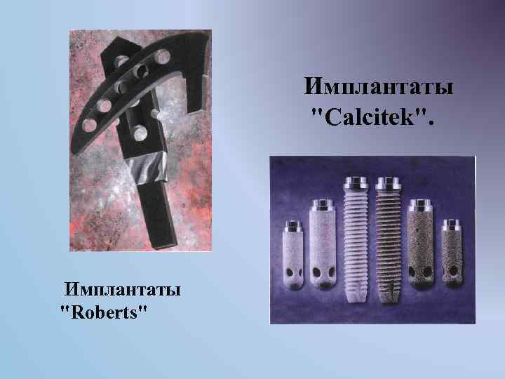 Имплантаты "Calcitek". Имплантаты "Roberts" 