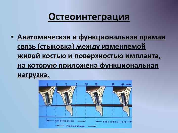 Анатомические предпосылки стоматологической имплантации презентация