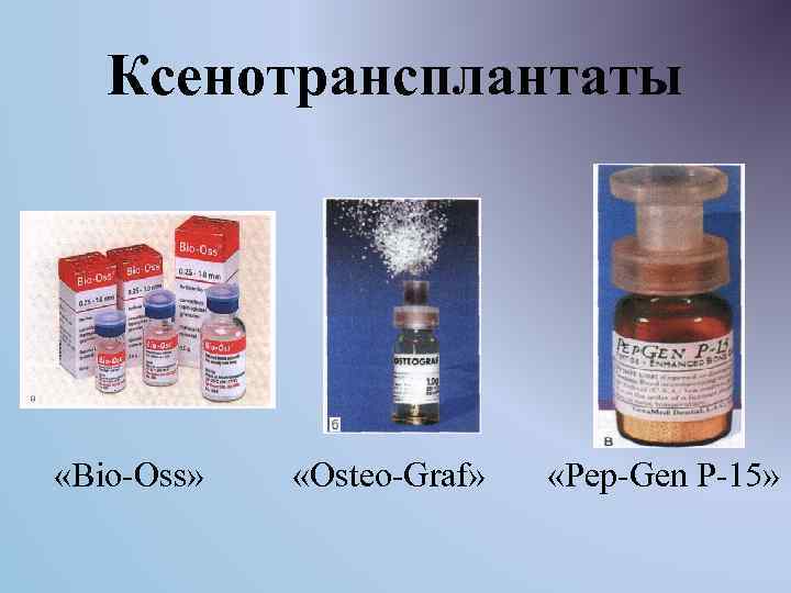 Ксенотрансплантаты «Bio-Oss» «Osteo-Graf» «Pep-Gen P-15» 