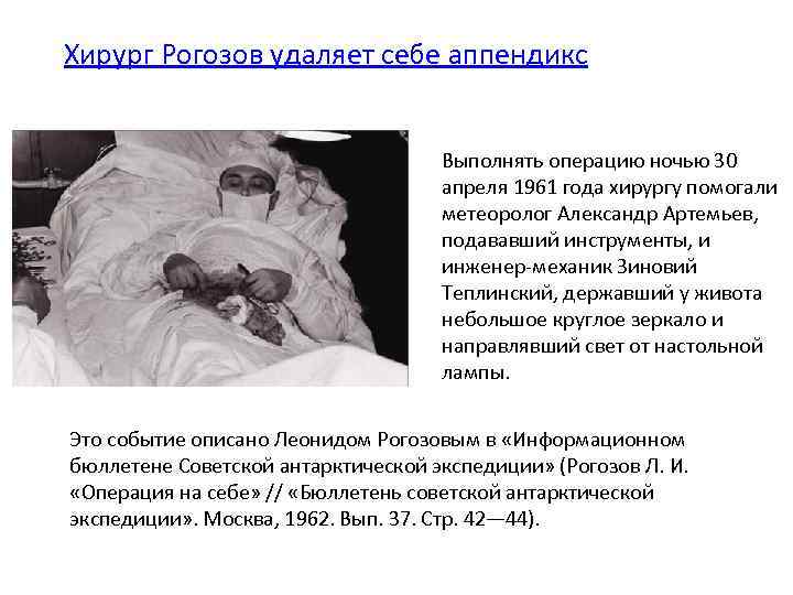 Хирург Рогозов удаляет себе аппендикс Выполнять операцию ночью 30 апреля 1961 года хирургу помогали