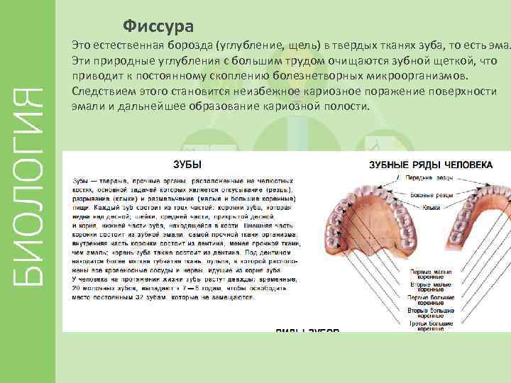 Фиссура Это естественная борозда (углубление, щель) в твердых тканях зуба, то есть эмал Эти