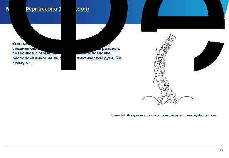 Фе Метод Фергюссона (Fergusson) Угол сколиоза образован пересечением линий, соединяющих геометрические центры нейтральных позвонков