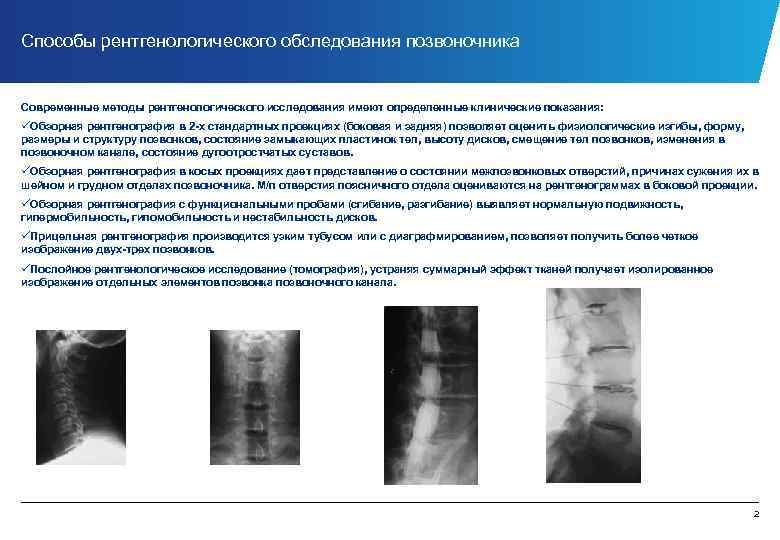 Способы рентгенологического обследования позвоночника Современные методы рентгенологического исследования имеют определенные клинические показания: üОбзорная рентгенография