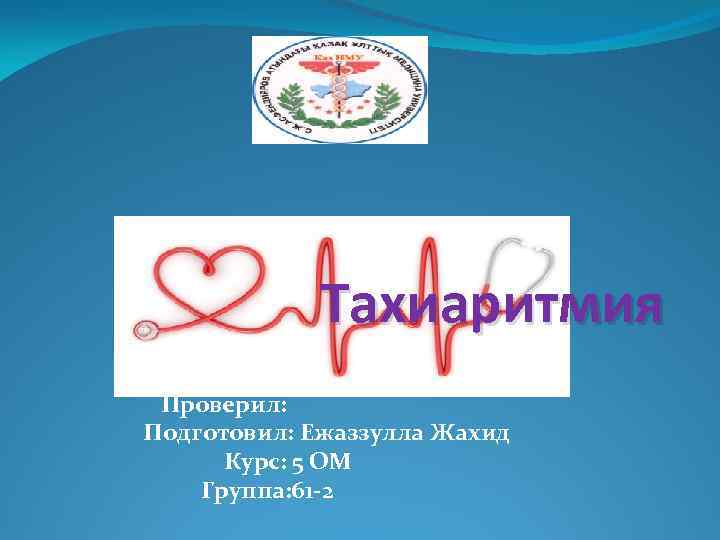 Тахиаритмия Проверил: Подготовил: Ежаззулла Жахид Курс: 5 ОМ Группа: 61 -2 
