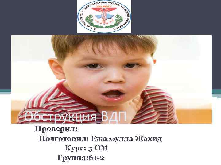Обструкция ВДП Проверил: Подготовил: Ежаззулла Жахид Курс: 5 ОМ Группа: 61 2 