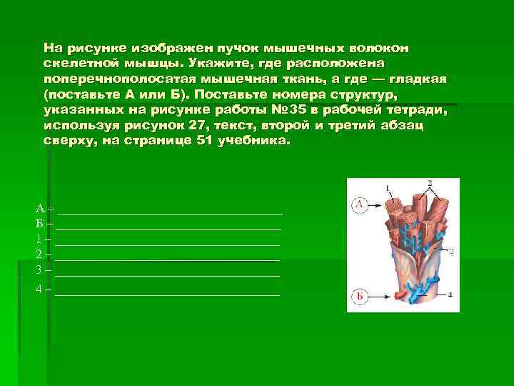 На рисунке изображен пучок мышечных волокон скелетной мышцы. Укажите, где расположена поперечнополосатая мышечная ткань,