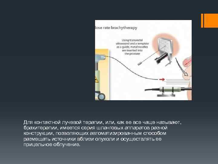 Для контактной лучевой терапии, или, как ее все чаще называют, брахитерапии, имеется серия шланговых