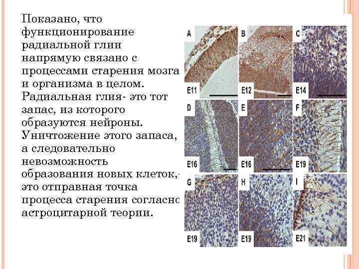 Показано, что функционирование радиальной глии напрямую связано с процессами старения мозга и организма в