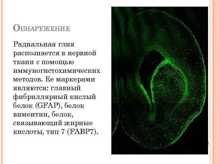 ОБНАРУЖЕНИЕ Радиальная глия распознается в нервной ткани с помощью иммуногистохимических методов. Ее маркерами являются: